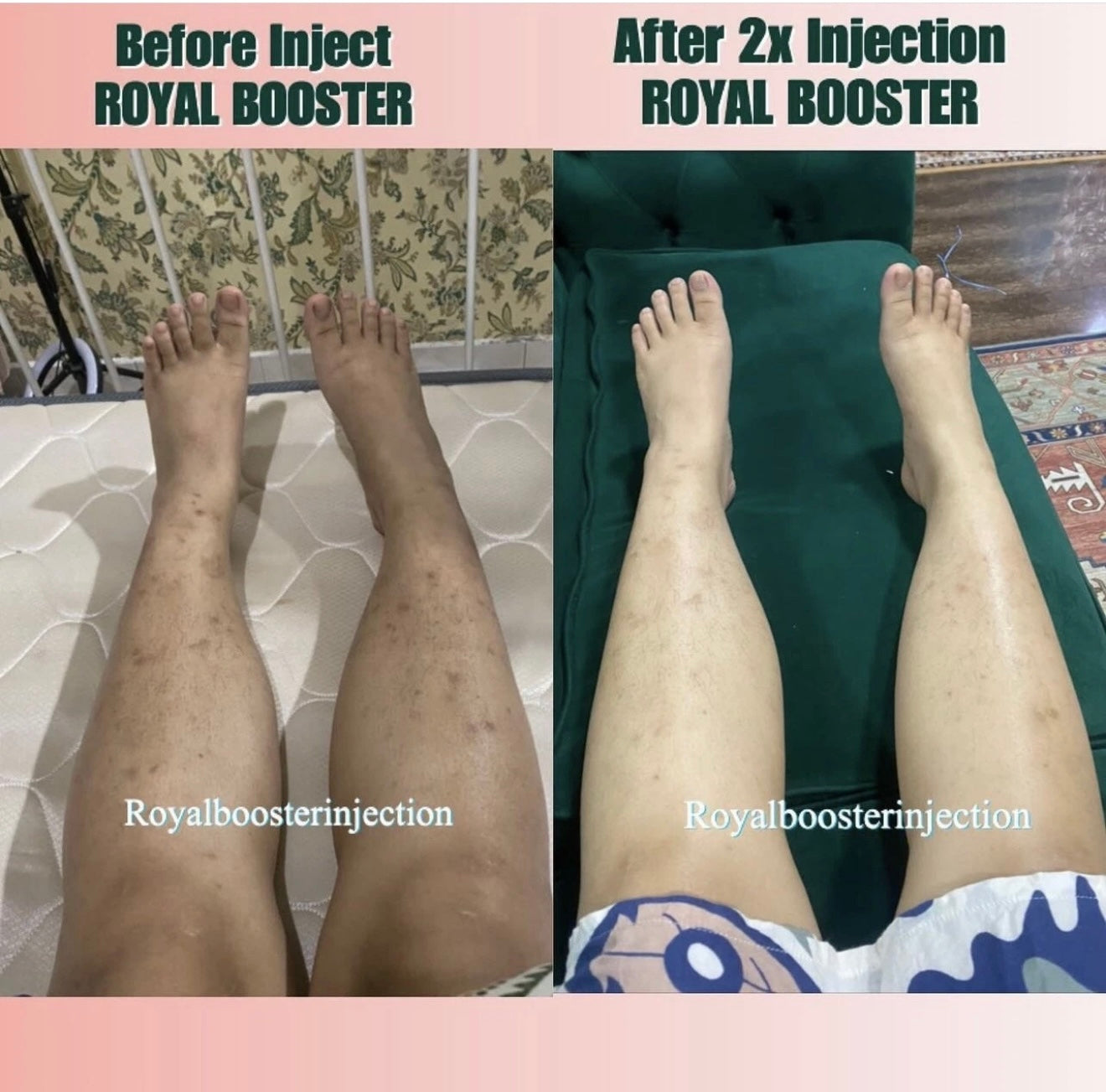 royal booster skin whitening