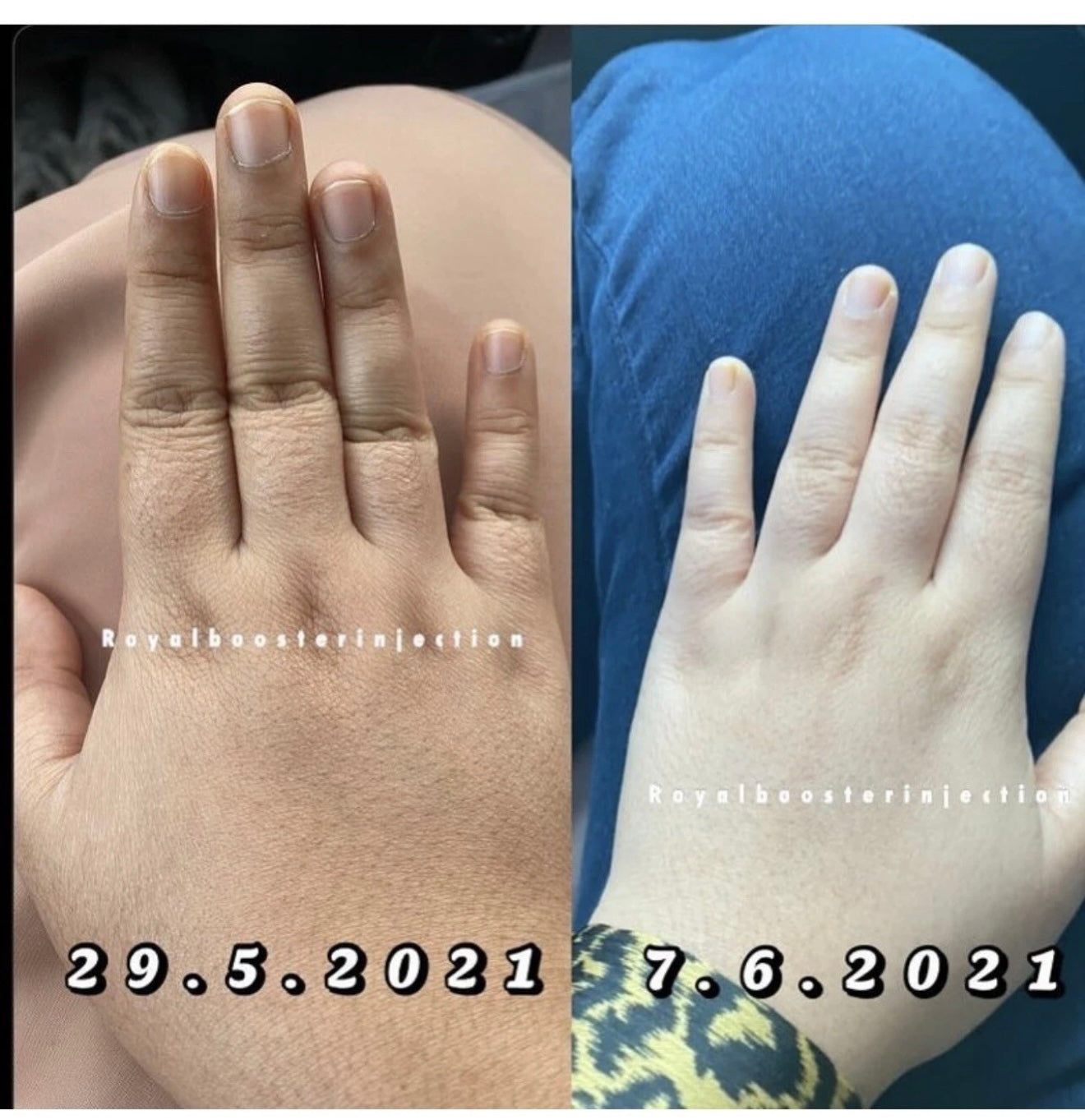 royal booster skin whitening