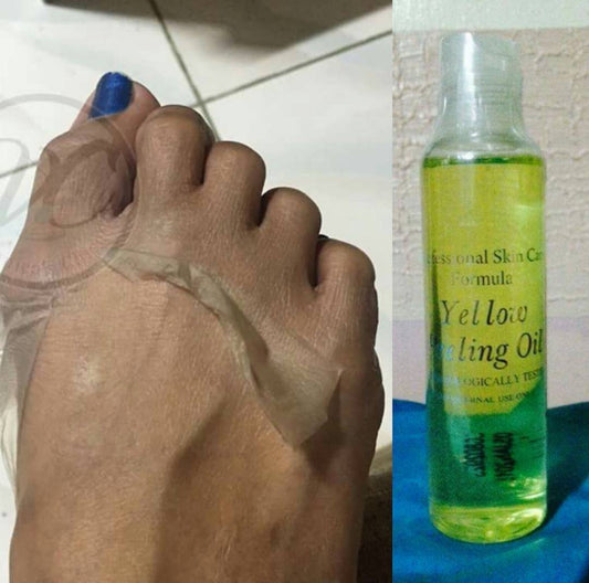 Yellow peeling oil